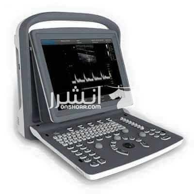 جهاز Chison ECO1 black and white 1 بروب 2سوكت مخرج شاشه مخرج فيديوبرنتر مخرجUSB الاسعار مفاجاه