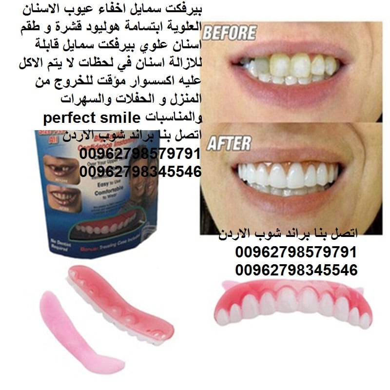 تركيب اسنان علوية بيرفكت سمايل اسنان اكسسوار : perfect smile اعمل تجميل لاسنانك بطريقة احترافية تركيب وتجميل لاسنانك فقط خلال 30 ثانية