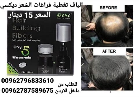 الحل الفوري للشعر الخفيف والصلع. والحل السريع والفعال لمظهر أنيق وجذاب