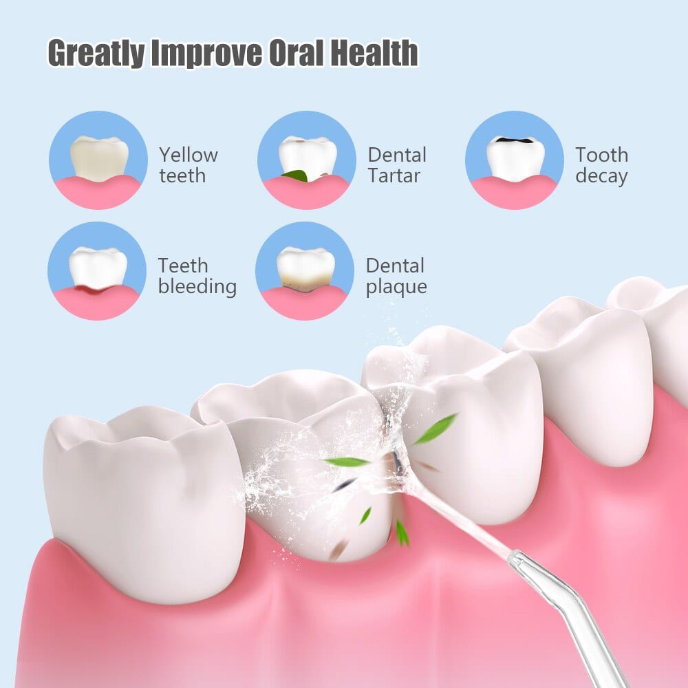 تنظيف بقايا الاكل Electric Oral تنظيف جسر الأسنان بالماء مضخه بديل الخيط شحن جهاز تنظيف الأسنان