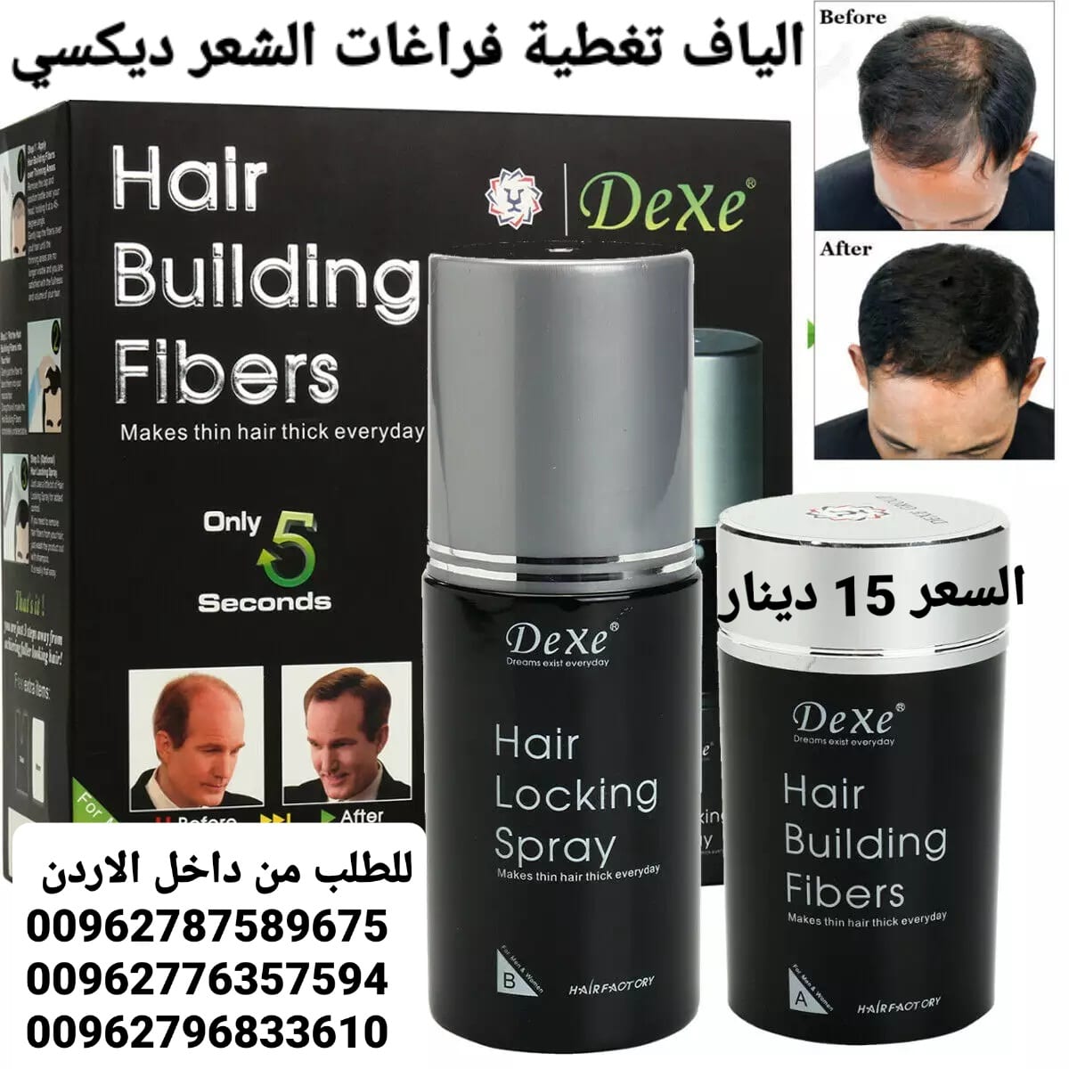 الياف شعر تغطية فراغات الشعر الخفيف والصلع ديكسي عند الرجال والنساء
