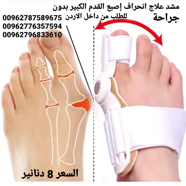 جهاز علاج انحراف إصبع القدم الكبير بدون جراحة