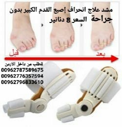علاج انحراف إصبع القدم الكبير بدون جراحة علاج اعوجاج إبهام القدم مشد طبي القدم علاج اصبع القدم