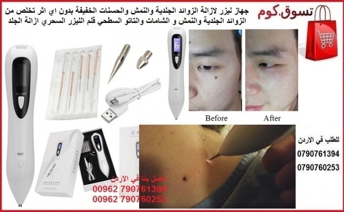 جهاز طبي ازالة زوائد الجلد و نمش الوجه يمكن علاج النمش وتجديد الجلد بواسطة استخدام