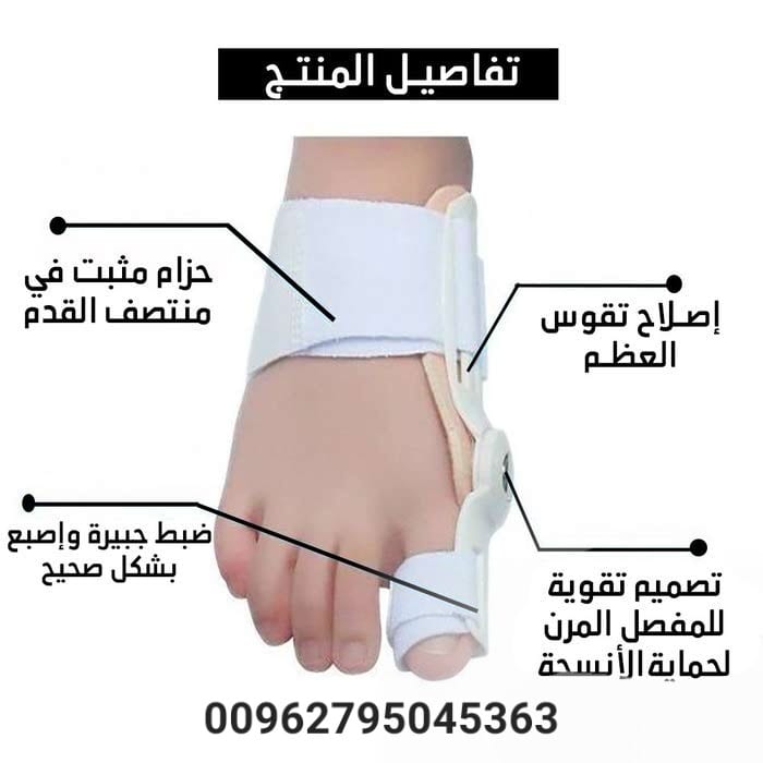 تصحيح انحراف ابهام القدم/ علاج انحراف اصبع القدم انحراف اصبع القدم الكبير