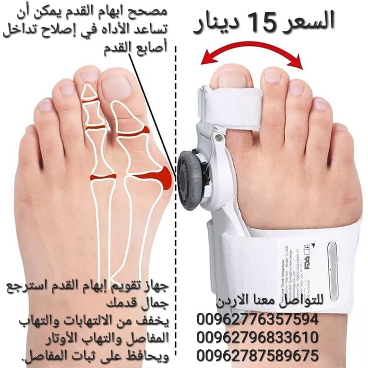 جهاز مصحح ابهام القدم الكبير يمكن أن تساعد الأداه في إصلاح تداخل أصابع القدم وأصابع القدم الملتوية ومشاكل القدم جهاز تعديل عظمة القدم الكبير