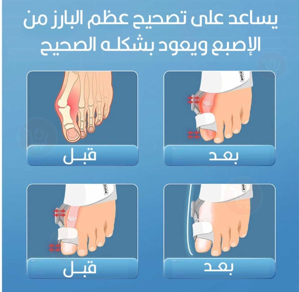 مشد الطبي لتصحيح انحراف تقويم الإصبع و مشد